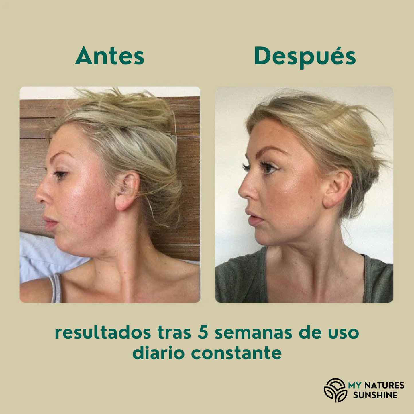 Lymphatic Drainage - Fórmula Herbal Líquida