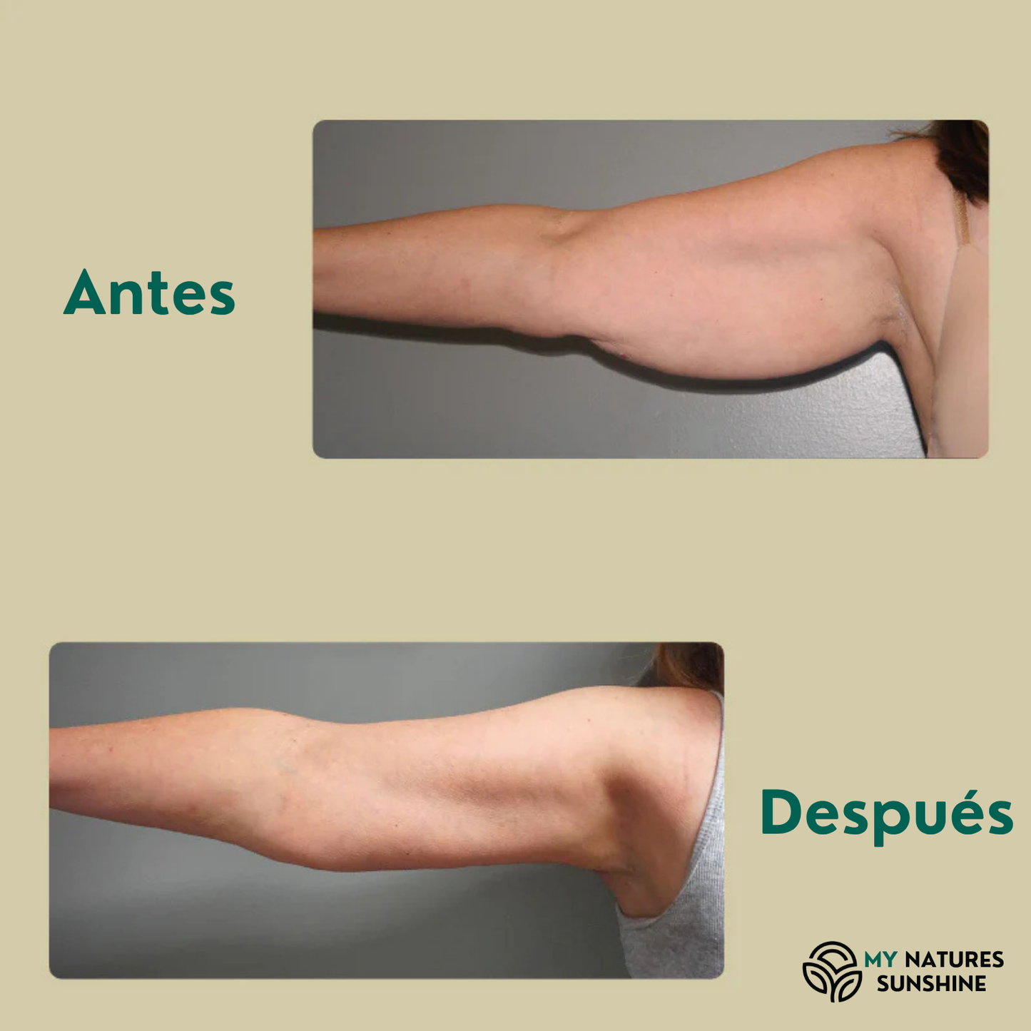 Lymphatic Drainage - Fórmula Herbal Líquida